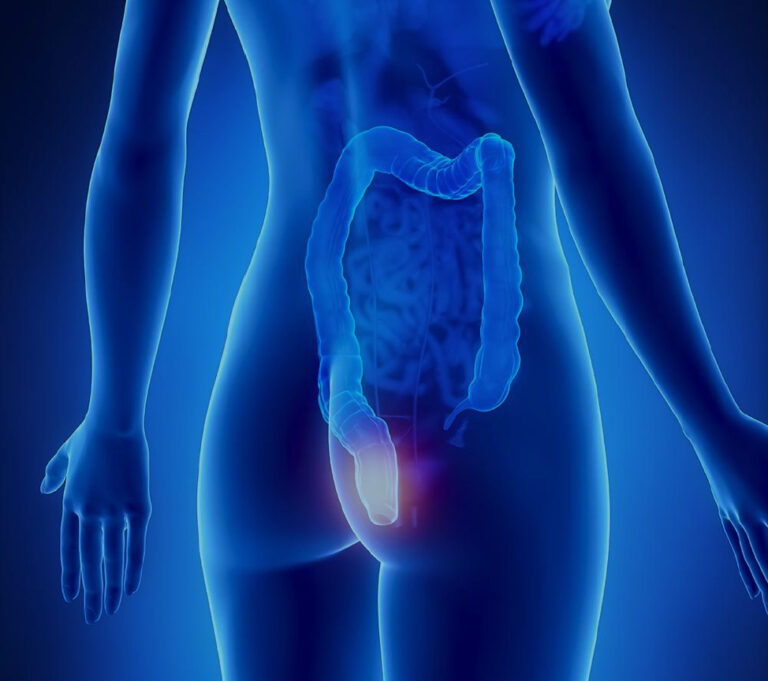 Proctologia-del-Dr Proctologia-del-Dr